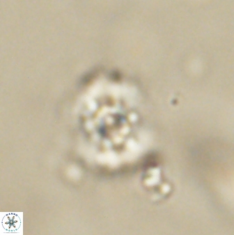 Cyclagelosphaera sp B 63701