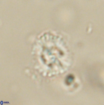 Cyclagelosphaera sp B 63702