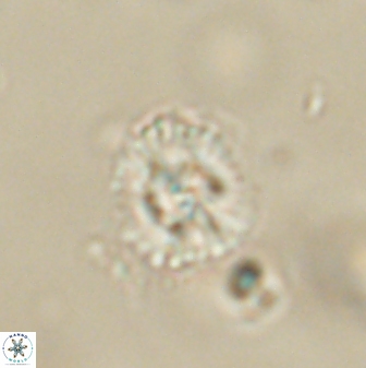 Cyclagelosphaera sp B 63702