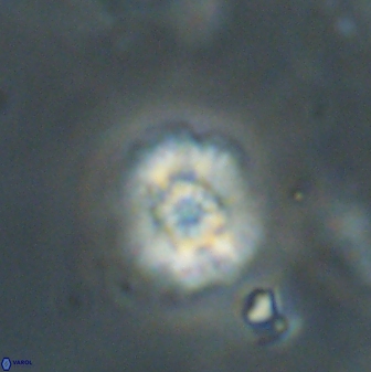 Cyclagelosphaera sp B 63703