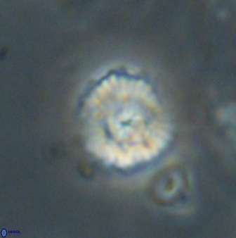 Cyclagelosphaera sp B 63704