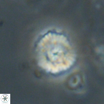 Cyclagelosphaera sp B 63704