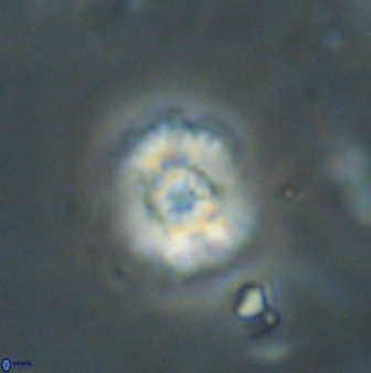 Cyclagelosphaera sp B 63705