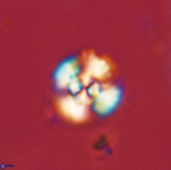 Cyclagelosphaera sp B 63706