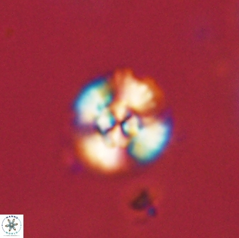Cyclagelosphaera sp B 63706
