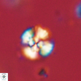 Cyclagelosphaera sp B 63708
