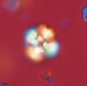 Cyclagelosphaera sp B 63711