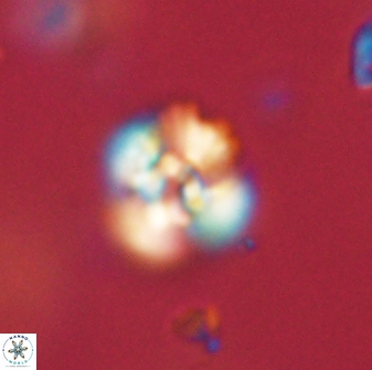 Cyclagelosphaera sp B 63711