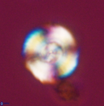 Cyclagelosphaera elevatocycla 11986