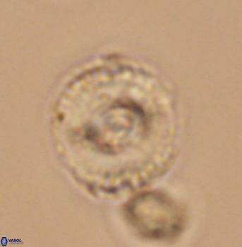 Cyclagelosphaera elevatocycla 11989