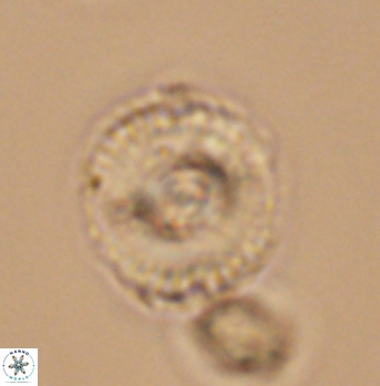Cyclagelosphaera elevatocycla 11989