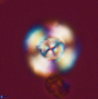 Cyclagelosphaera elevatocycla 11995