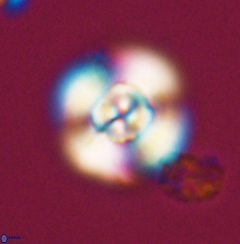 Cyclagelosphaera elevatocycla 11998