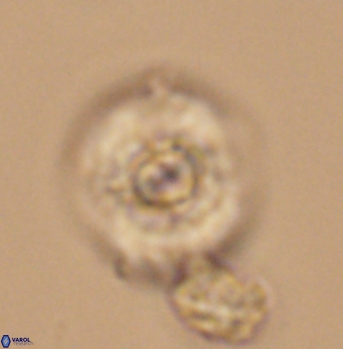 Cyclagelosphaera elevatocycla 11990