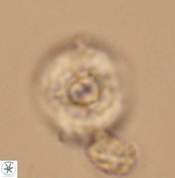Cyclagelosphaera elevatocycla 11990