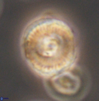 Cyclagelosphaera elevatocycla 11991