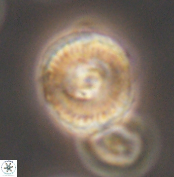 Cyclagelosphaera elevatocycla 11991
