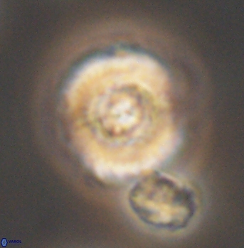 Cyclagelosphaera elevatocycla 11992