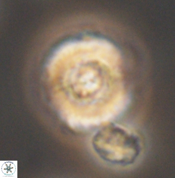 Cyclagelosphaera elevatocycla 11992