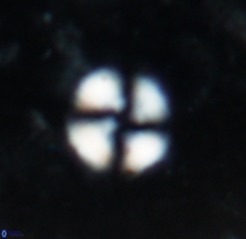 Cyclagelosphaera spp 1839