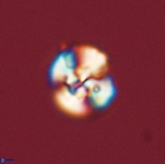 Cyclagelosphaera tetracycla 58438