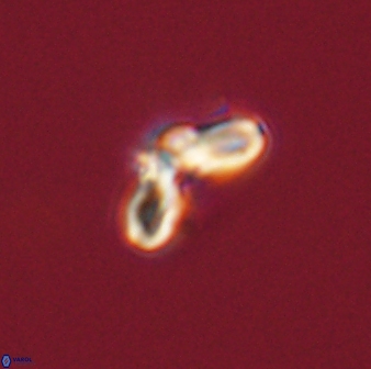 Cyclagelosphaera tetracycla 58441
