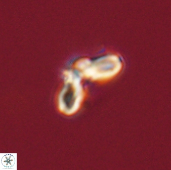 Cyclagelosphaera tetracycla 58441