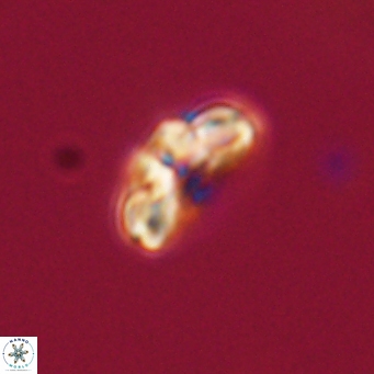 Cyclagelosphaera tetracycla 64244
