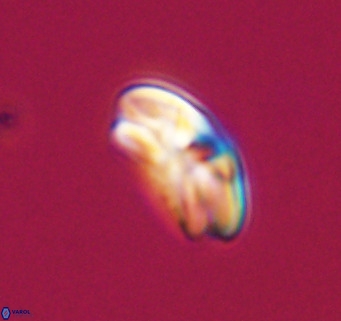 Cyclicargolithus neogammation VR 33761