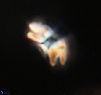 Cyclicargolithus neogammation VR 33771