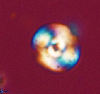 Cyclicargolithus neogammation VR 33780