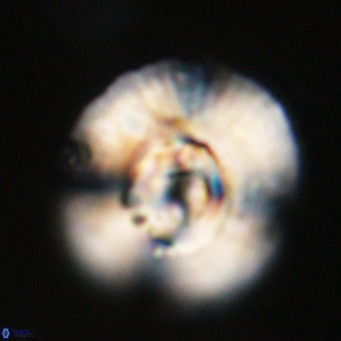 Cyclicargolithus abisectus VR 31595