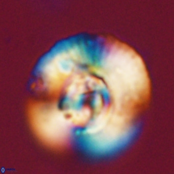 Cyclicargolithus abisectus VR 31596