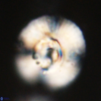 Cyclicargolithus abisectus VR 31598