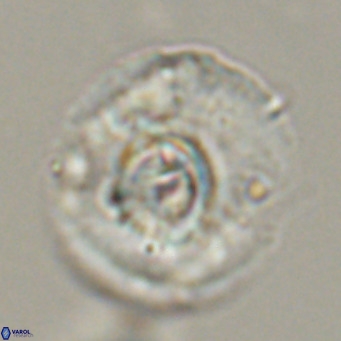Cyclicargolithus abisectus VR 31599