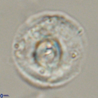 Cyclicargolithus abisectus VR 31600