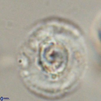 Cyclicargolithus abisectus VR 31601