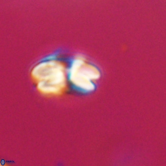 Cyclicargolithus floridanus VR 31387
