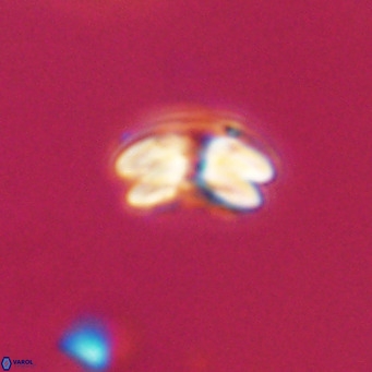 Cyclicargolithus floridanus VR 31388