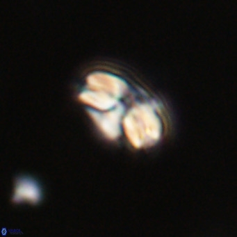 Cyclicargolithus floridanus VR 31391
