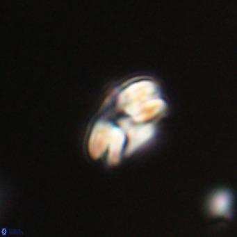 Cyclicargolithus floridanus VR 31394