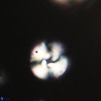 Cyclicargolithus floridanus VR 31395