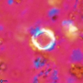 Cylindralithus crassus VR 21146