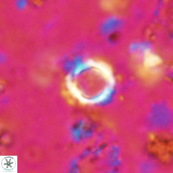 Cylindralithus crassus VR 21146