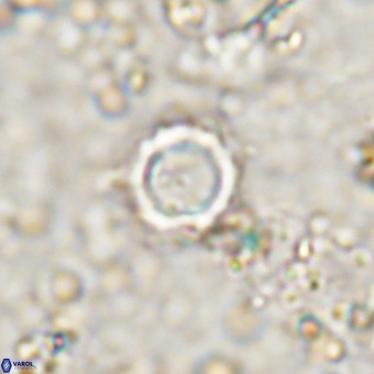 Cylindralithus crassus VR 21155