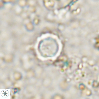 Cylindralithus crassus VR 21155