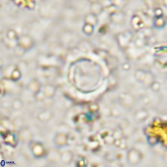 Cylindralithus crassus VR 21157