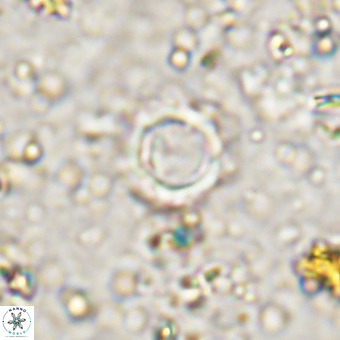 Cylindralithus crassus VR 21157