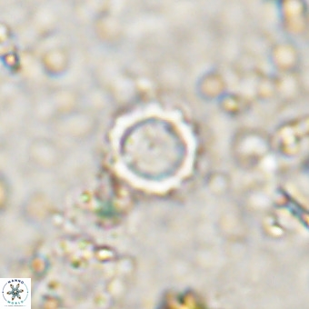 Cylindralithus crassus VR 21158