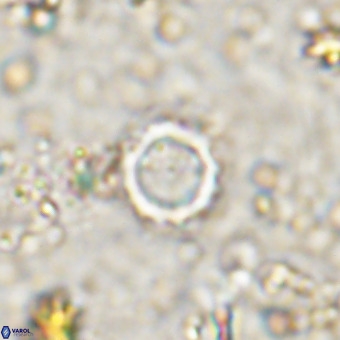Cylindralithus crassus VR 21159